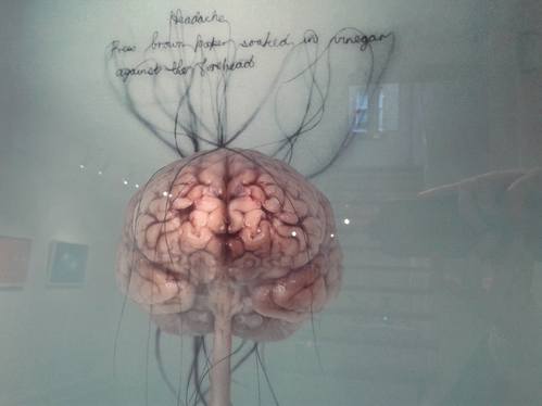 GV Art - Head Ache by Helen Pynor